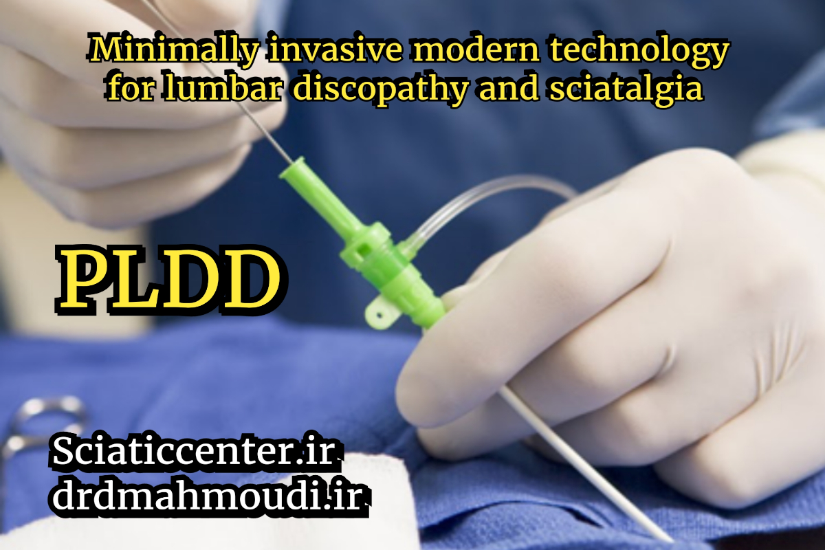 عمل دیسک کمر با لیزر یا (PLDD) چیست؟